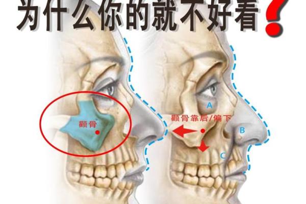 面相分析：颧骨突出的命运影响与解读